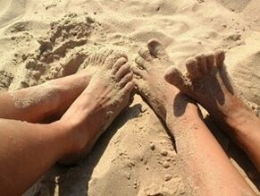 Infekcija stopala na plaži