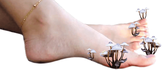 gljivice na stopalima