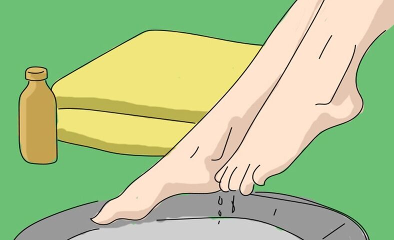 Kupka od jabukovog sirćeta protiv gljivica stopala